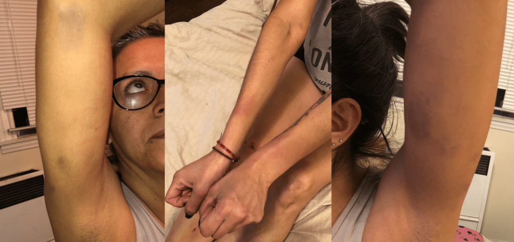 USC’s Public Safety Officers Tackle, Traumatize Woman for Hugging Tree on Sorority’s Lawn